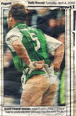 hibs009