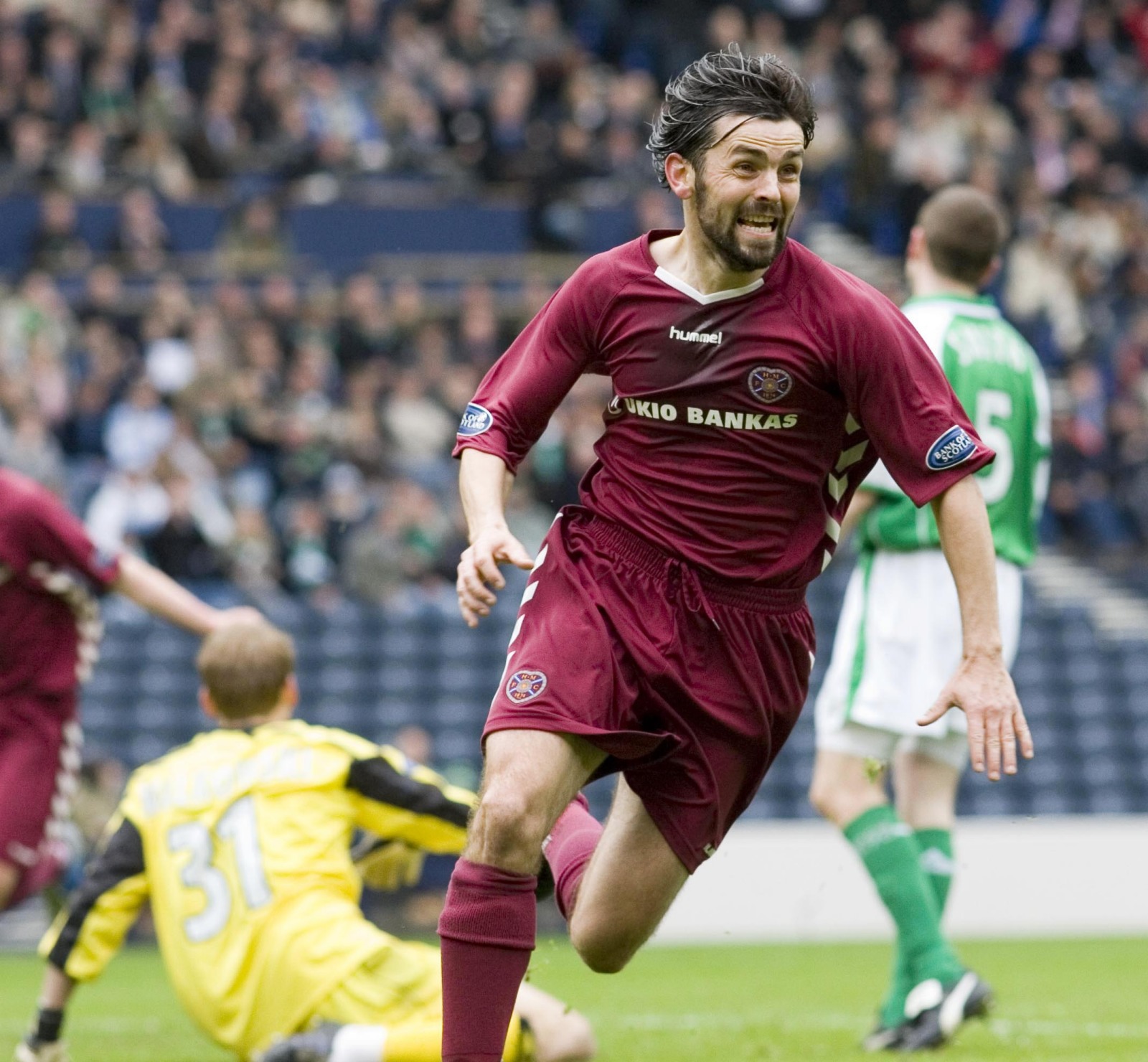Hartley Large 2 v Hibs