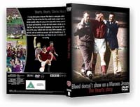 dvd1